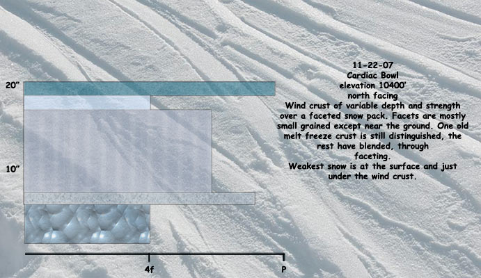 cardiac bowl snow profile